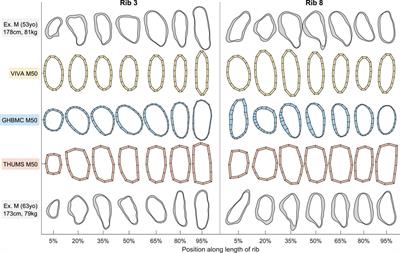 Cross-sectional properties of rib geometry from an adult population